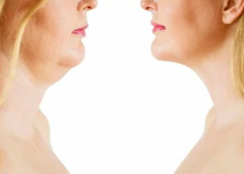 Trucos y consejos para favorecer el aspecto de la papada sin cirugía