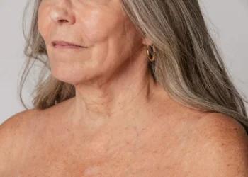 Las manchas de la edad: Cómo y por qué se forman